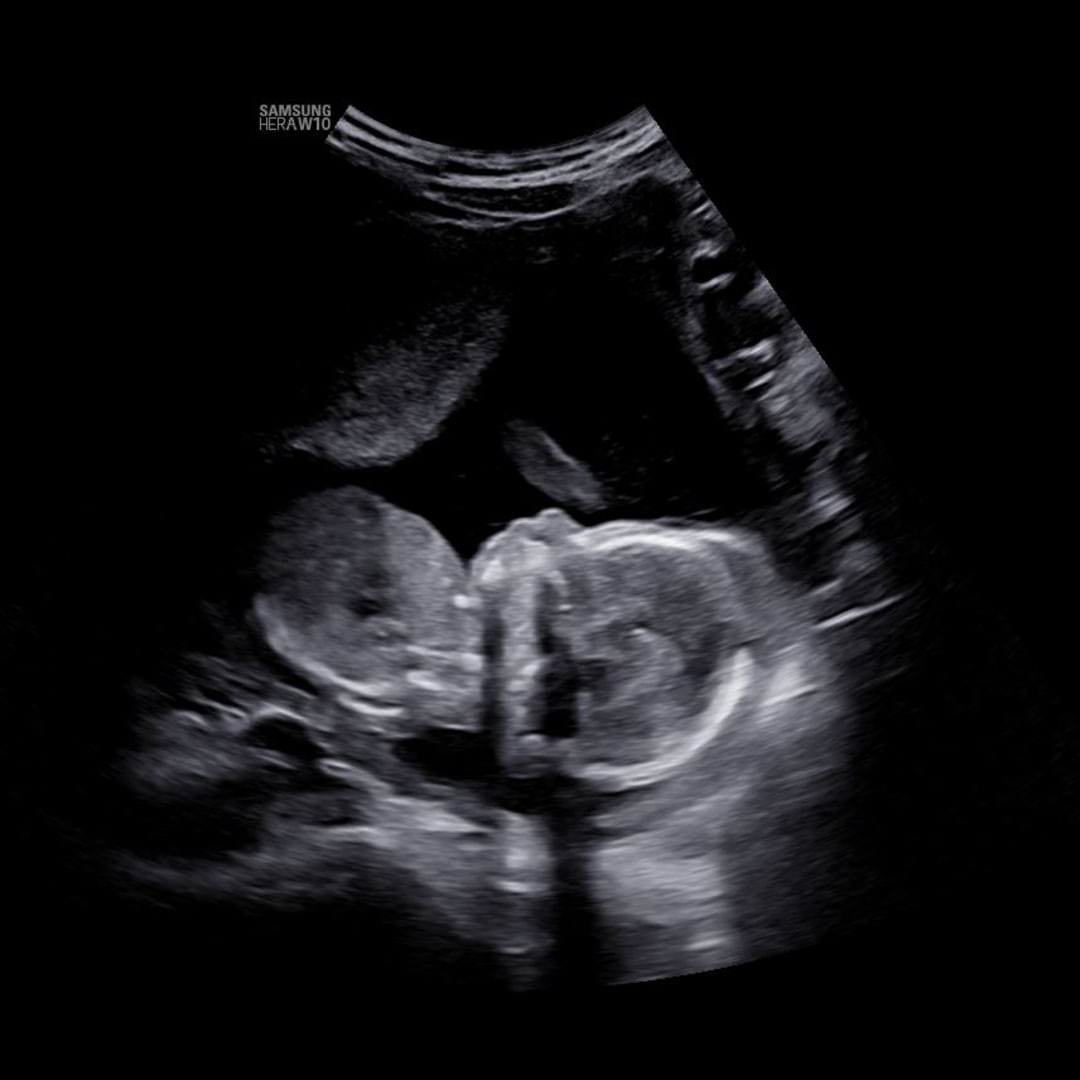 Photo shared by Chanel for their Babylist baby registry.