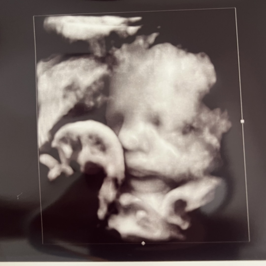 Photo shared by Courtney for their Babylist baby registry.