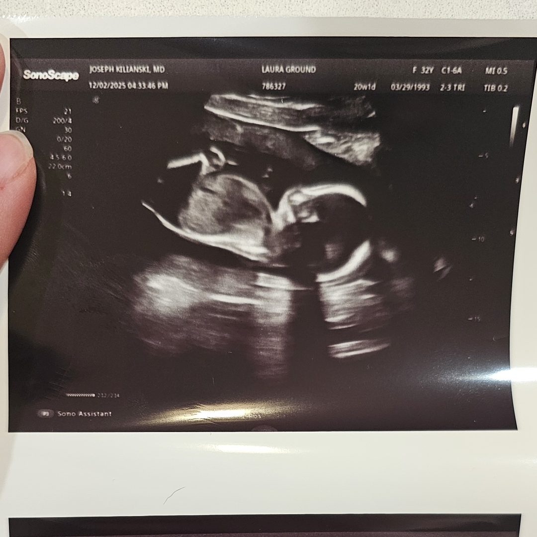 Photo shared by Laura for their Babylist baby registry.