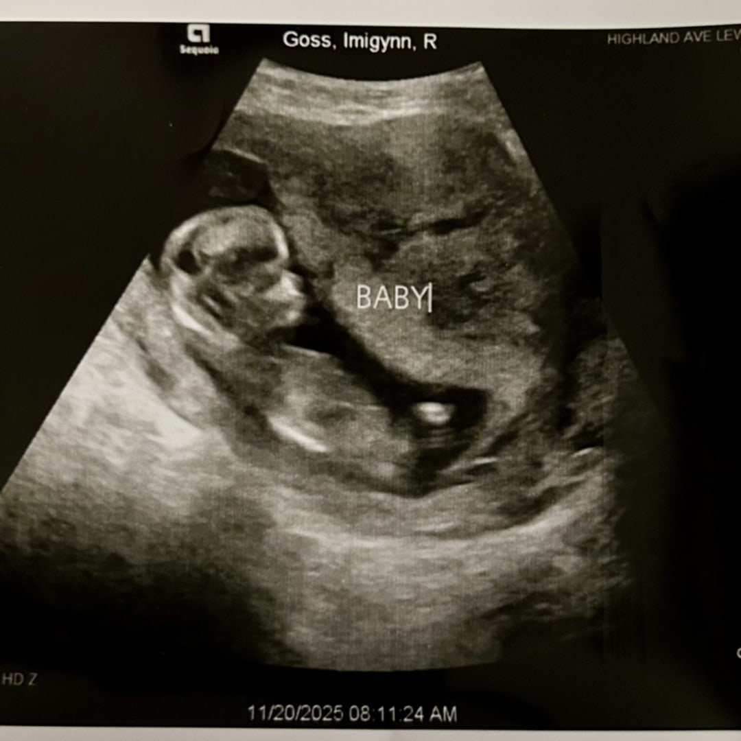 Photo shared by Imigynn for their Babylist baby registry.