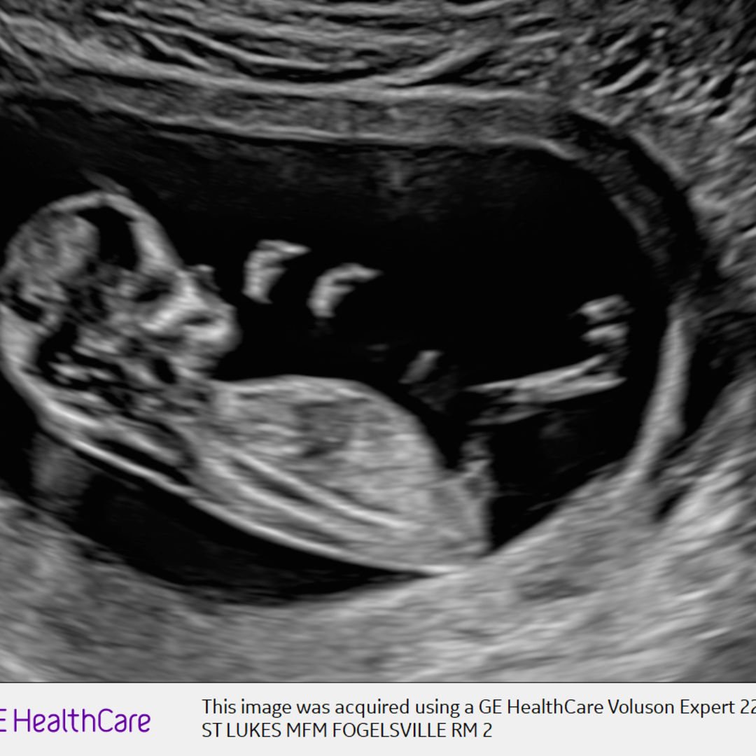 Photo shared by Hunter for their Babylist baby registry.