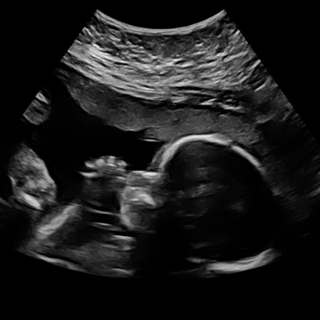 Photo shared by Ellie for their Babylist baby registry.