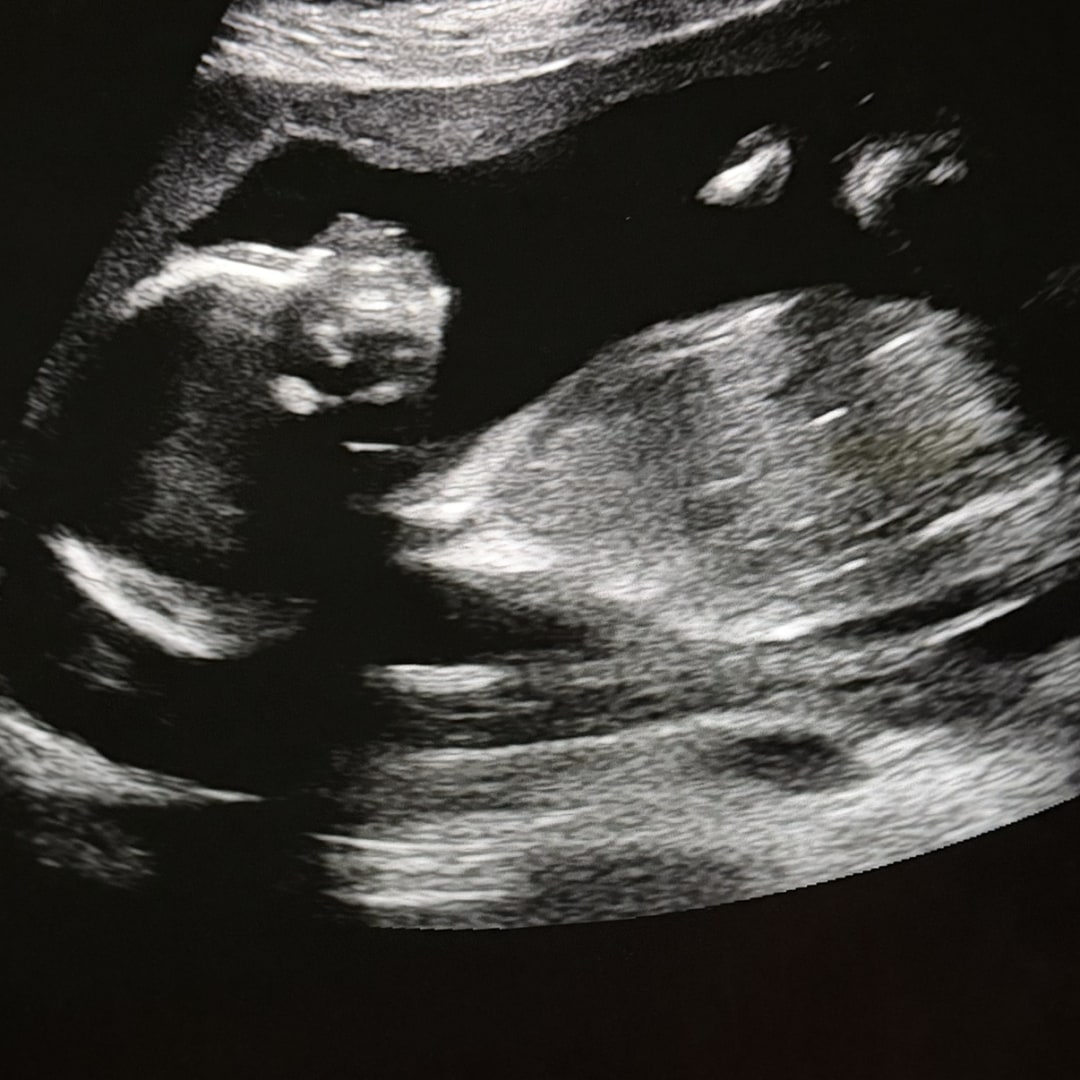 Photo shared by Rebecca for their Babylist baby registry.