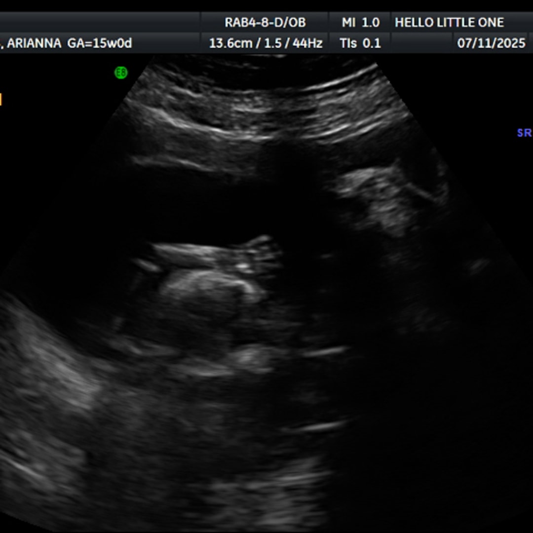 Photo shared by Arianna for their Babylist baby registry.
