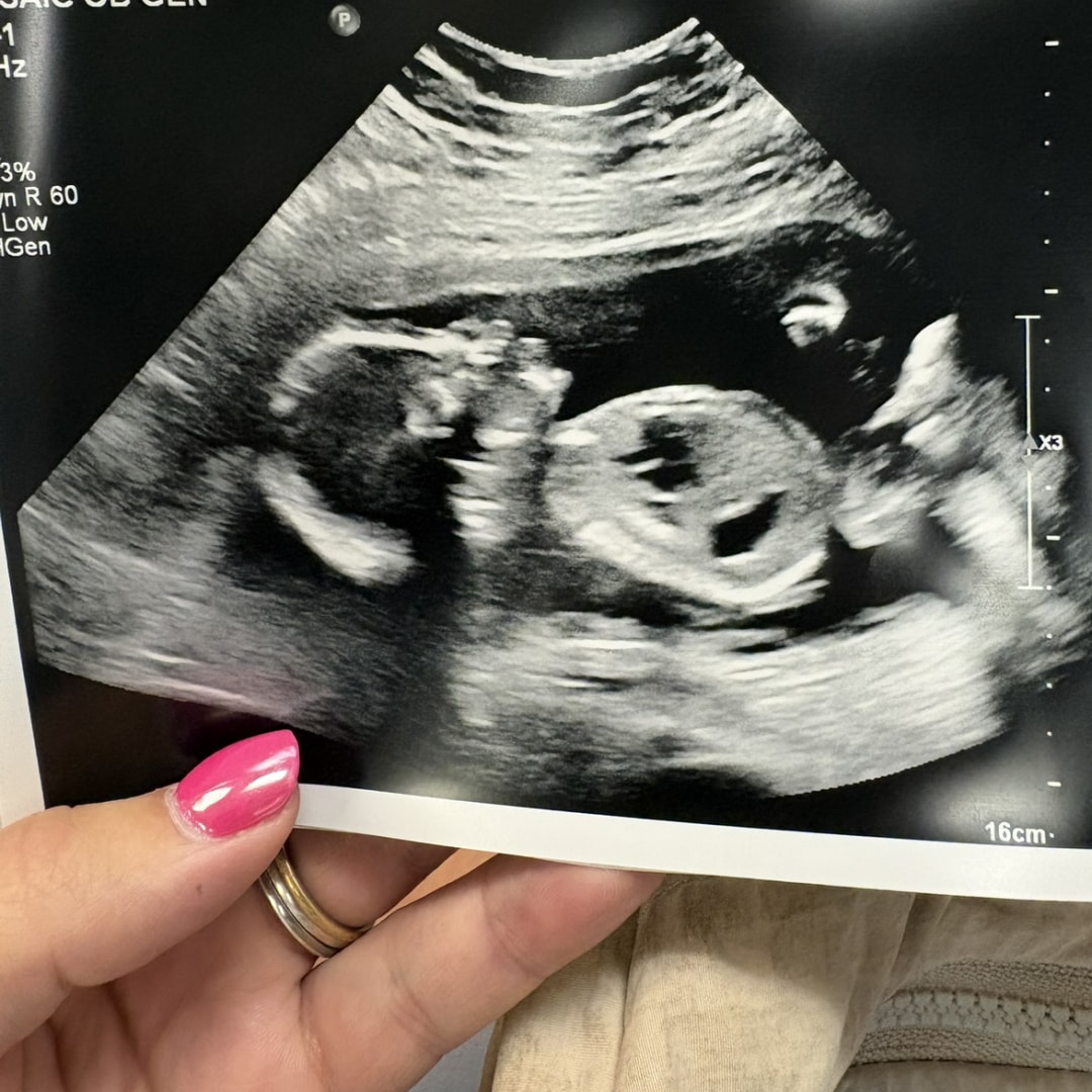 Photo shared by Brandi for their Babylist baby registry.