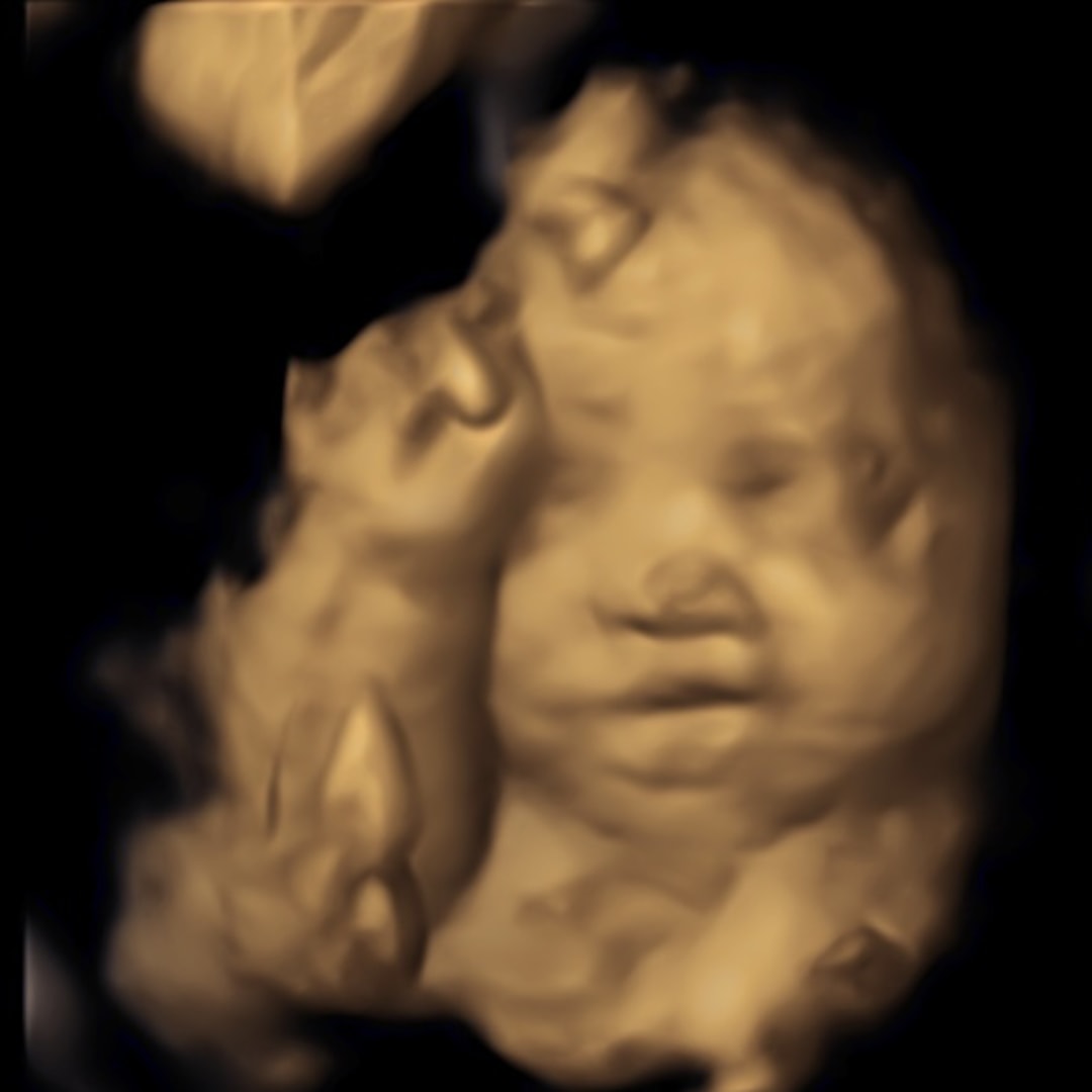 Photo shared by Bailey for their Babylist baby registry.
