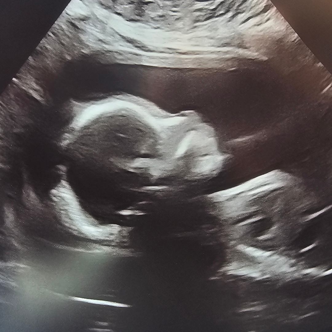 Photo shared by Katie for their Babylist baby registry.