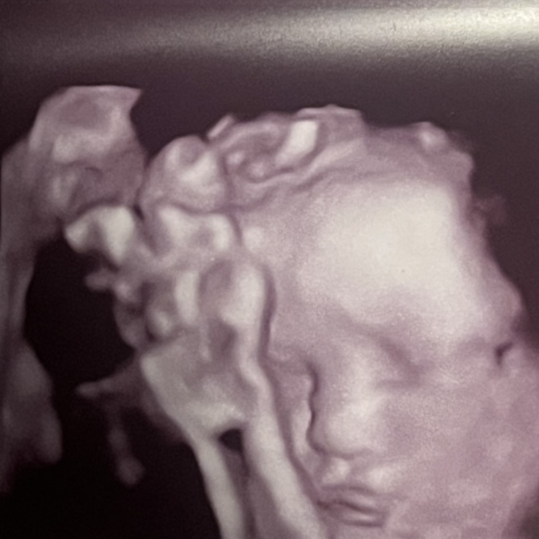 Photo shared by Trinity for their Babylist baby registry.