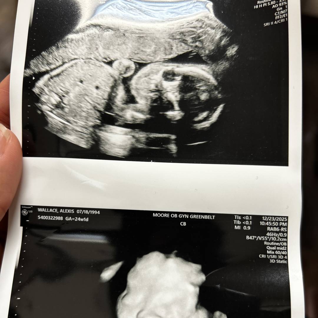 Photo shared by Alexis for their Babylist baby registry.