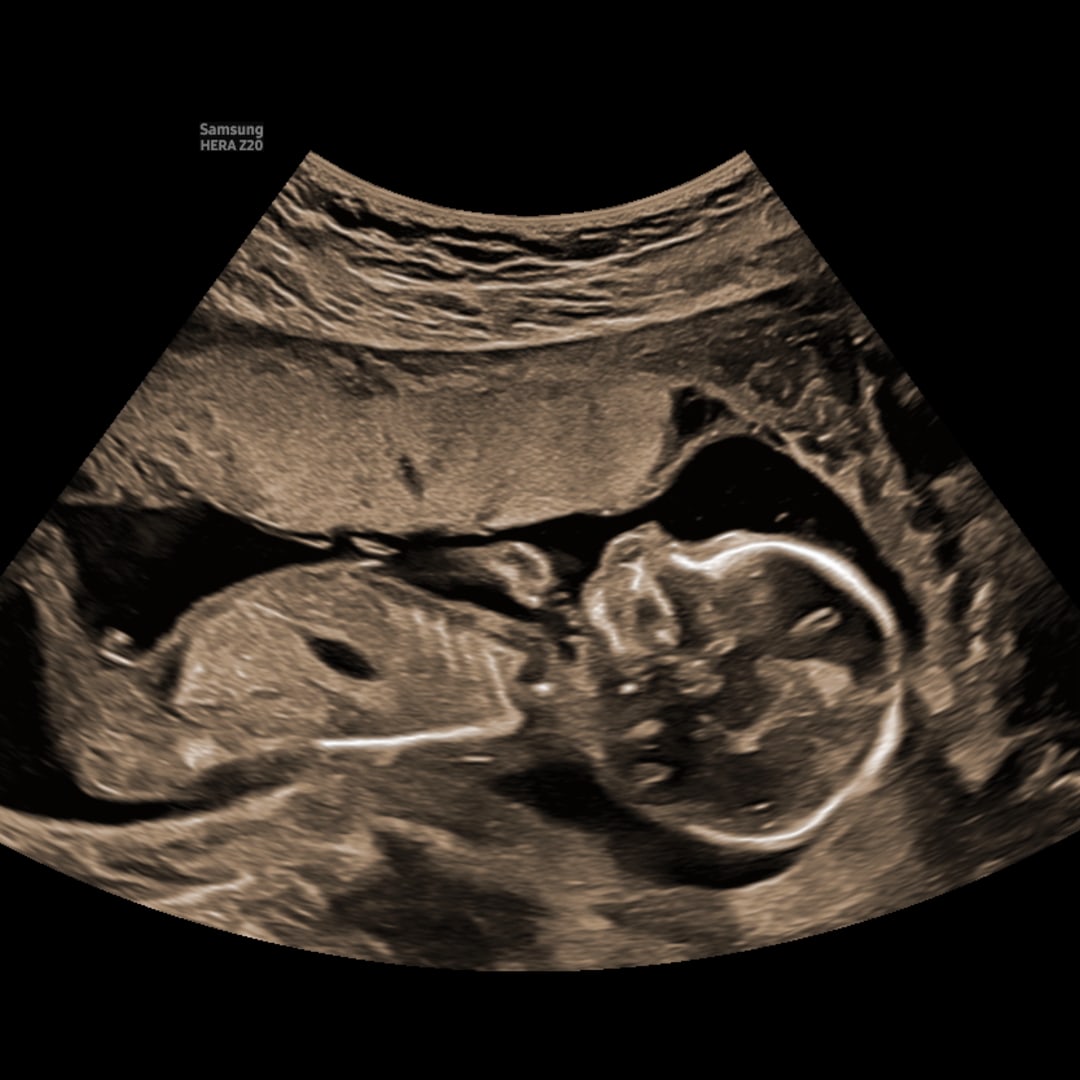 Photo shared by Rochelle for their Babylist baby registry.