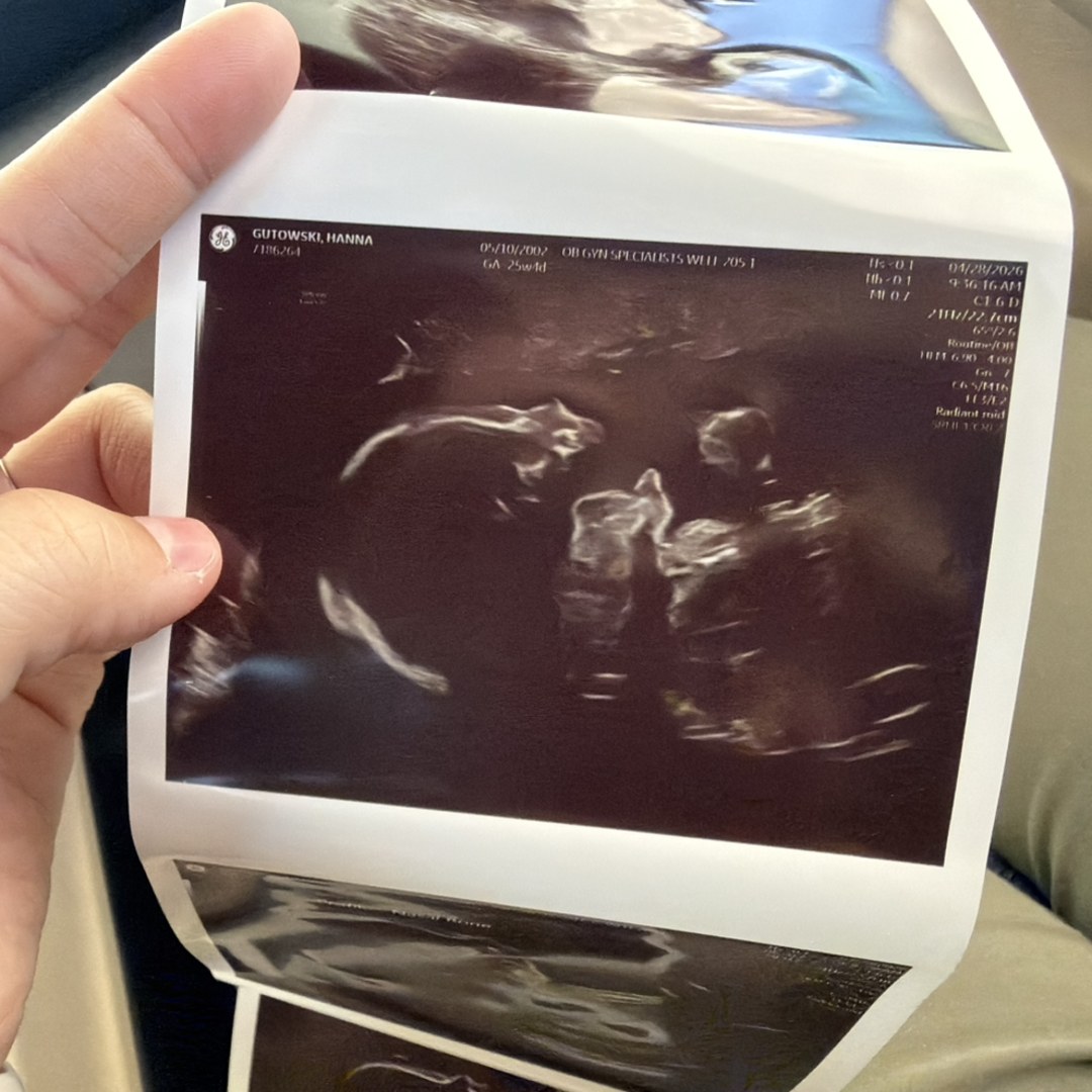 Photo shared by Hanna for their Babylist baby registry.