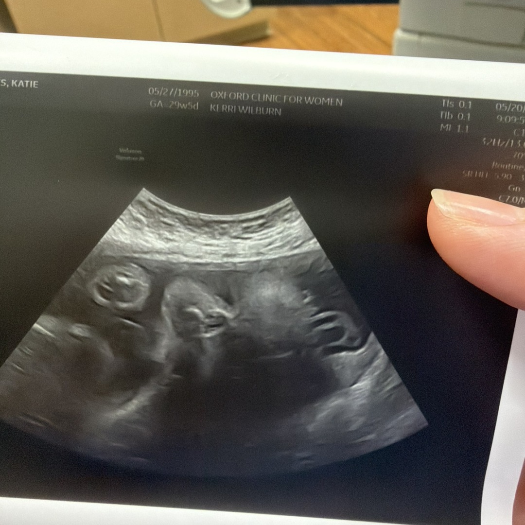 Photo shared by Katie for their Babylist baby registry.
