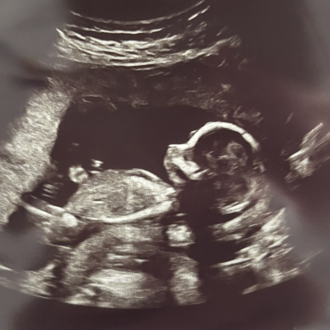 Photo shared by Amanda for their Babylist baby registry.