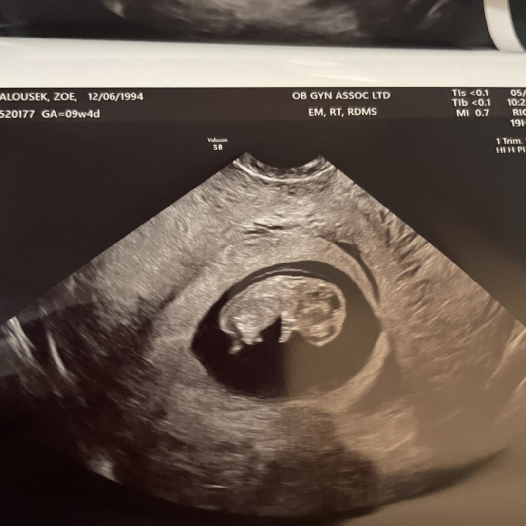 Photo shared by Zoe for their Babylist baby registry.