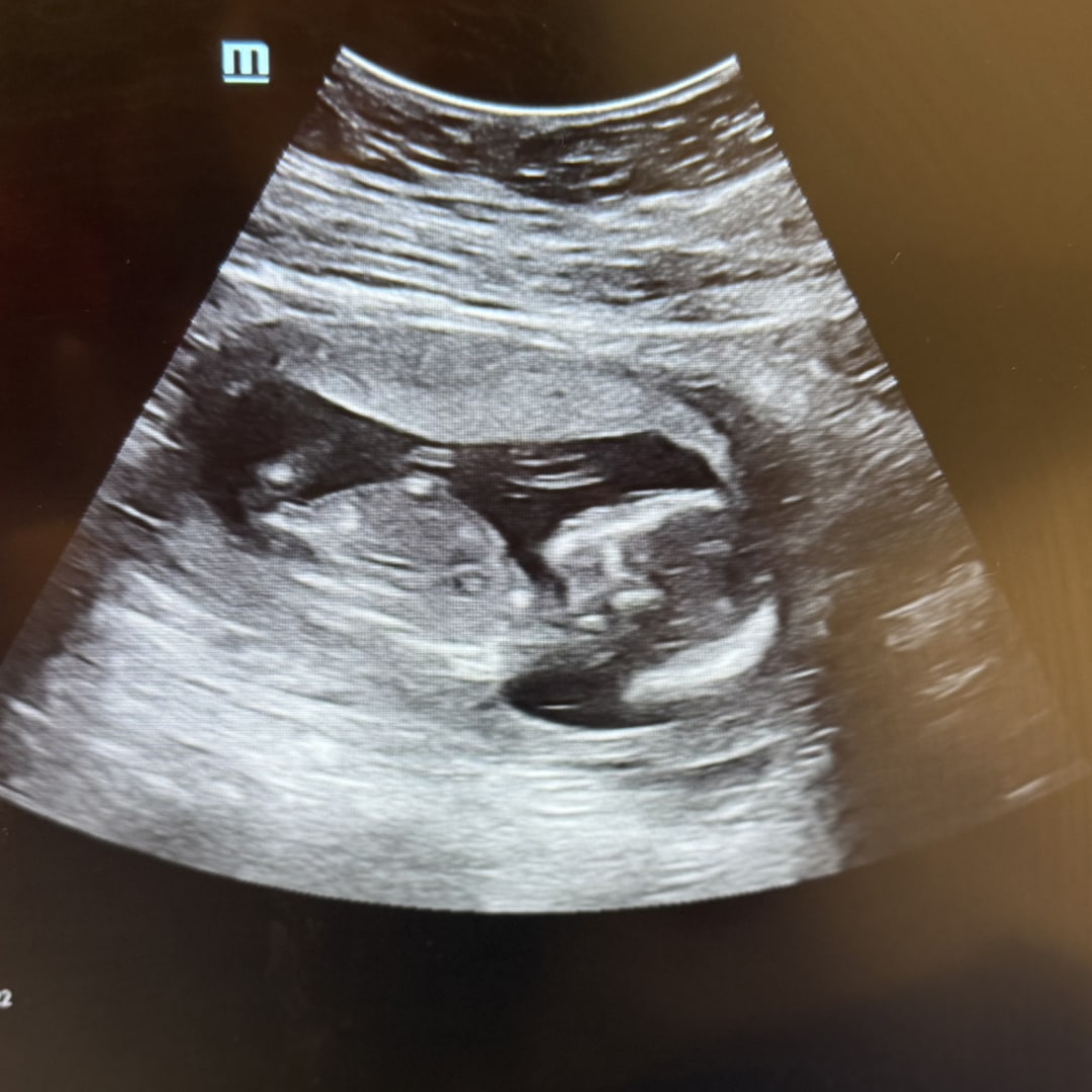 Photo shared by Katy-Lynn for their Babylist baby registry.