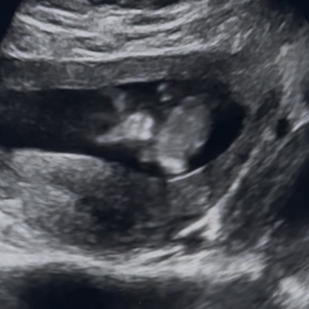 Photo shared by Hope for their Babylist baby registry.