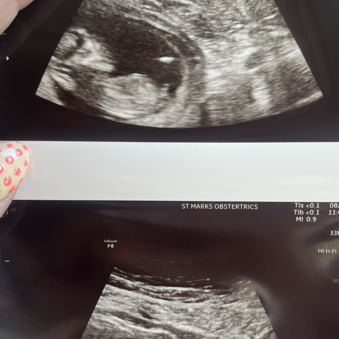 Photo shared by Savanna for their Babylist baby registry.