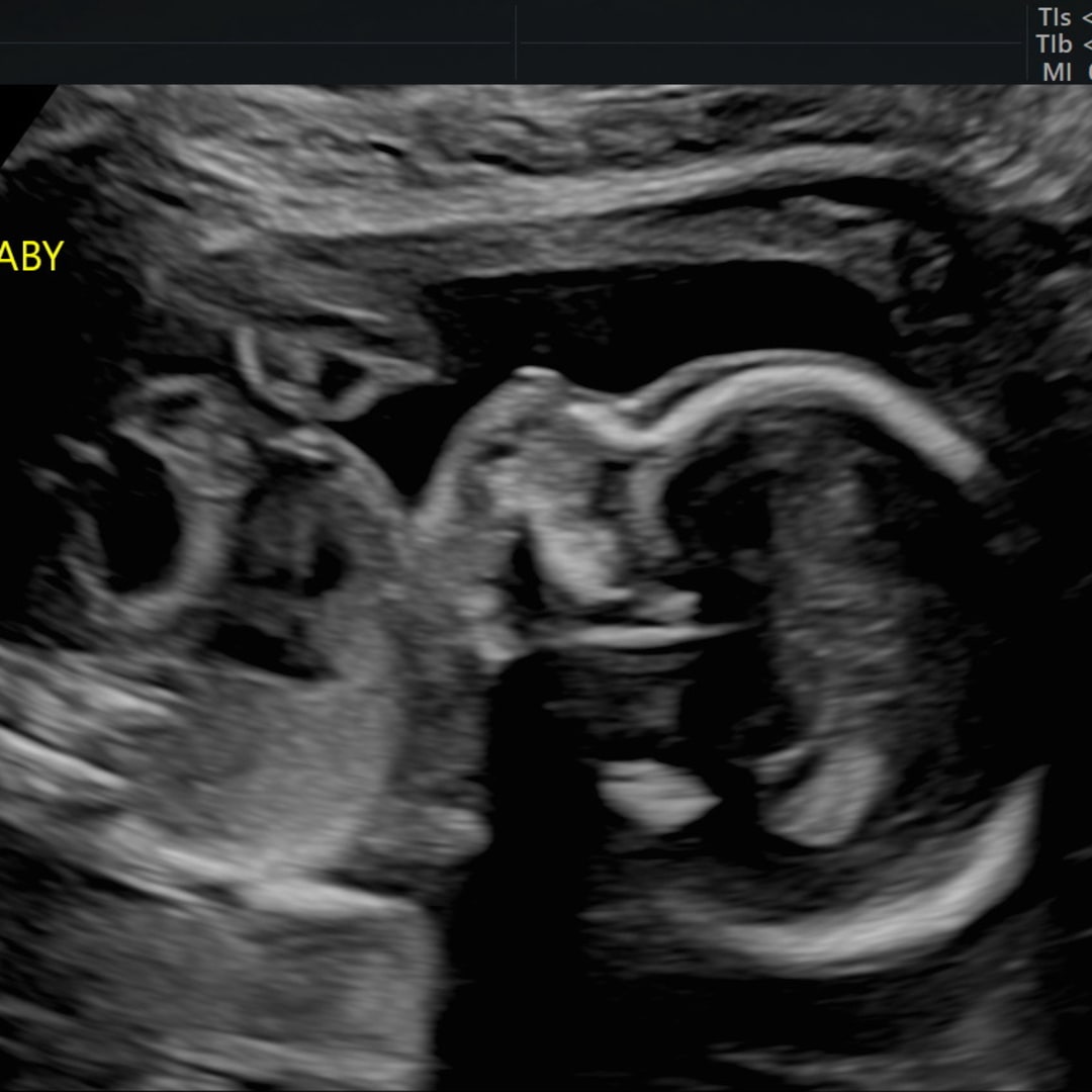 Photo shared by Brianna for their Babylist baby registry.