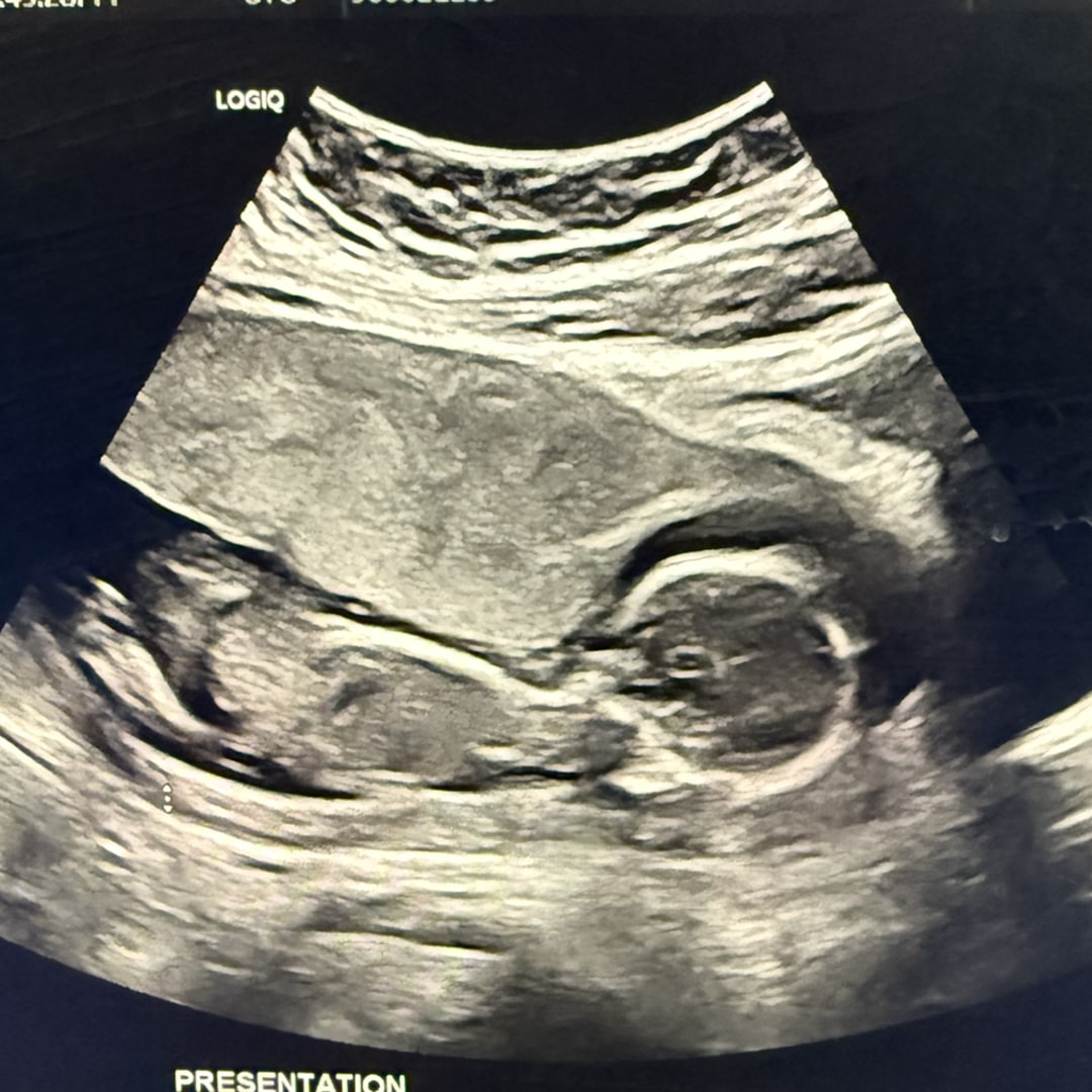 Photo shared by Kadajah for their Babylist baby registry.