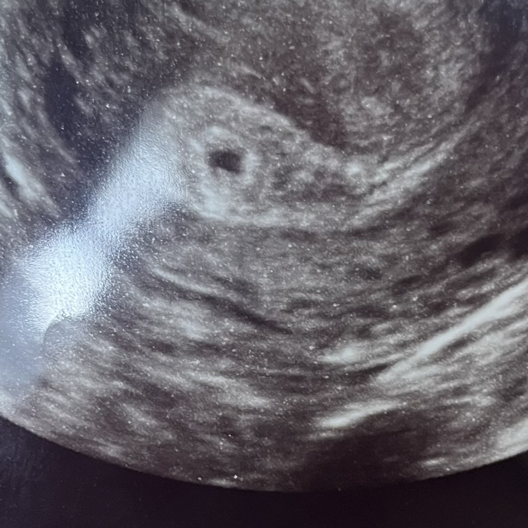 Photo shared by Robyn for their Babylist baby registry.