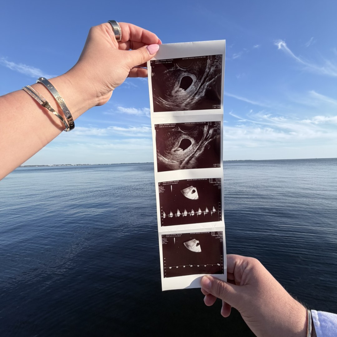 Photo shared by Kate for their Babylist baby registry.