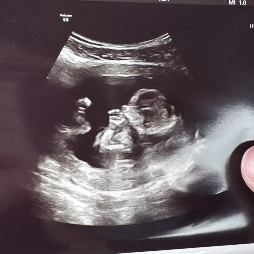 Photo shared by Isabel for their Babylist baby registry.