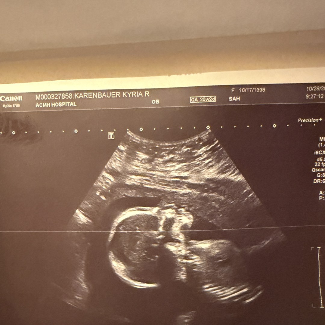 Photo shared by Kyria for their Babylist baby registry.