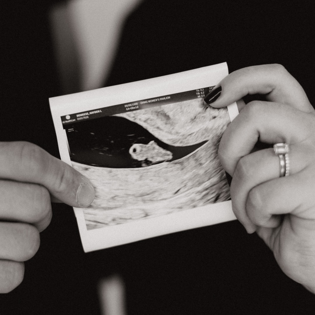 Photo shared by Hayden for their Babylist baby registry.