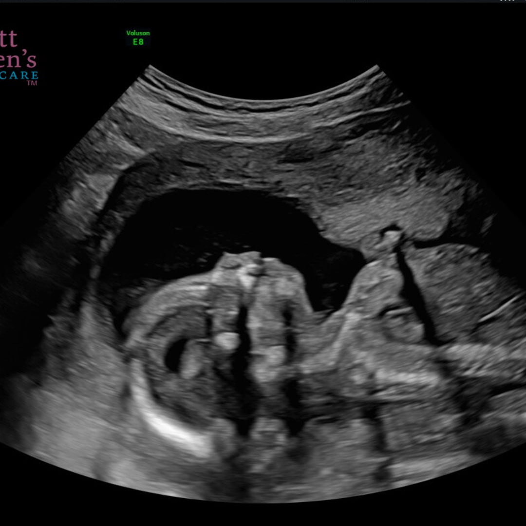 Photo shared by Jenikah for their Babylist baby registry.