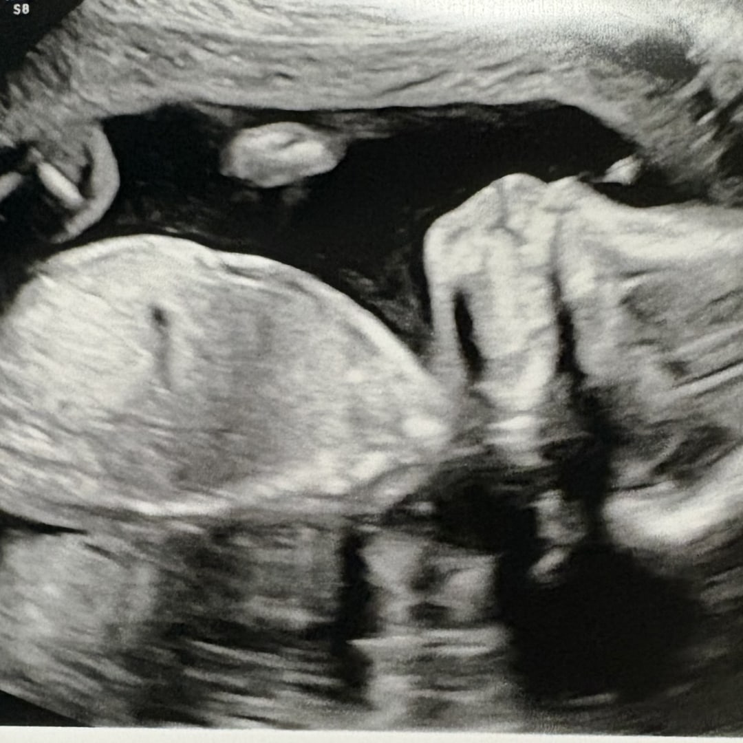 Photo shared by Emerald for their Babylist baby registry.