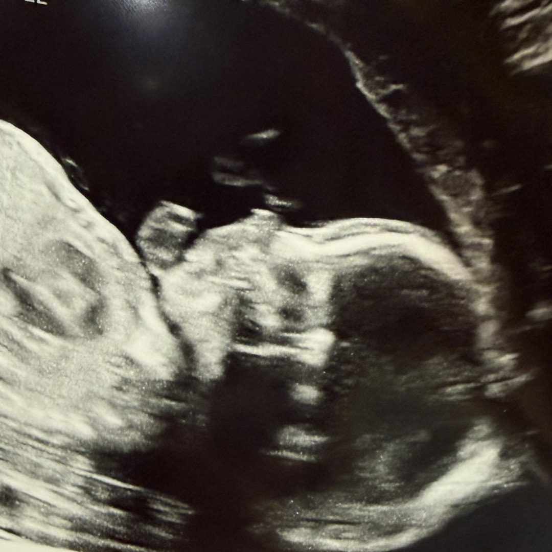 Photo shared by Paige for their Babylist baby registry.
