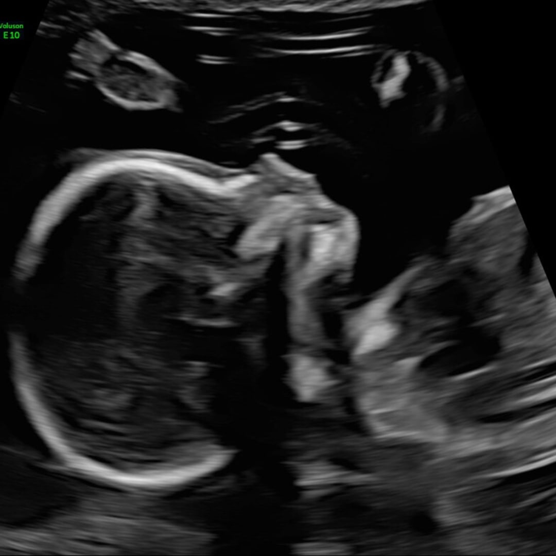 Photo shared by Meg for their Babylist baby registry.