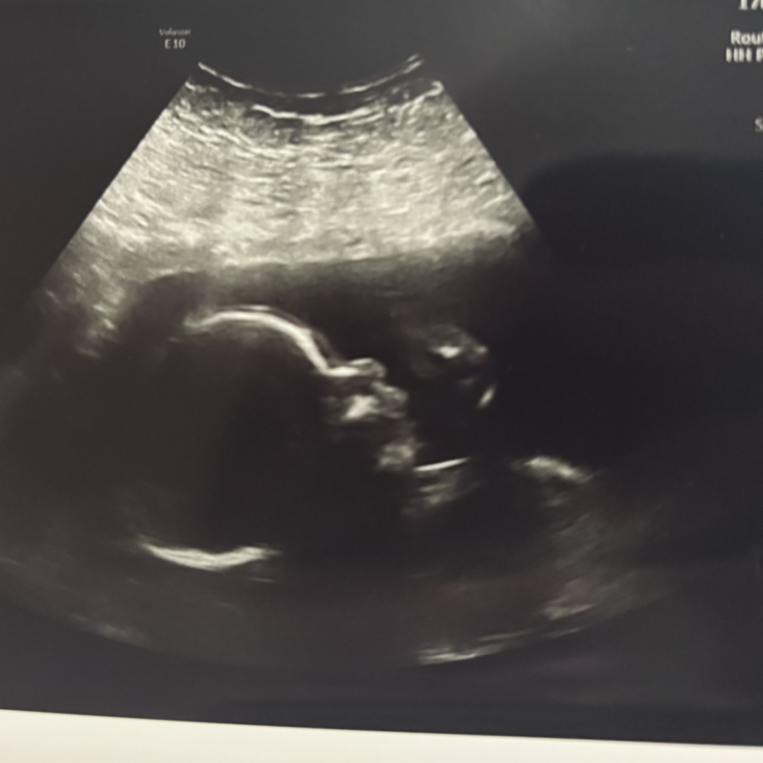 Photo shared by Brittany for their Babylist baby registry.