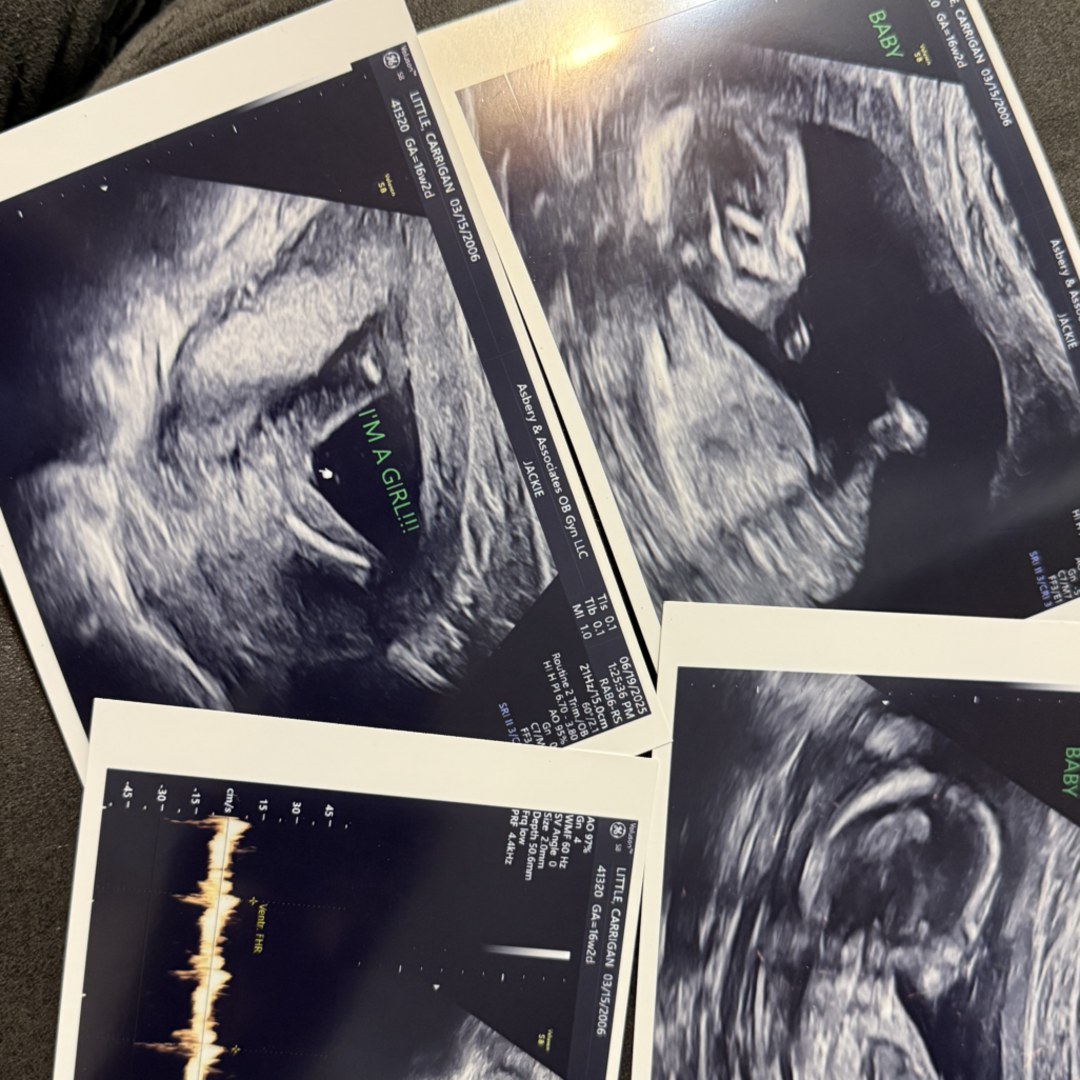 Photo shared by Carrigan for their Babylist baby registry.