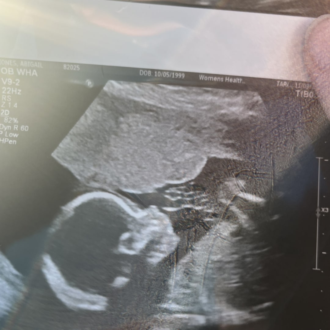 Photo shared by Wintana and Abby for their Babylist baby registry.
