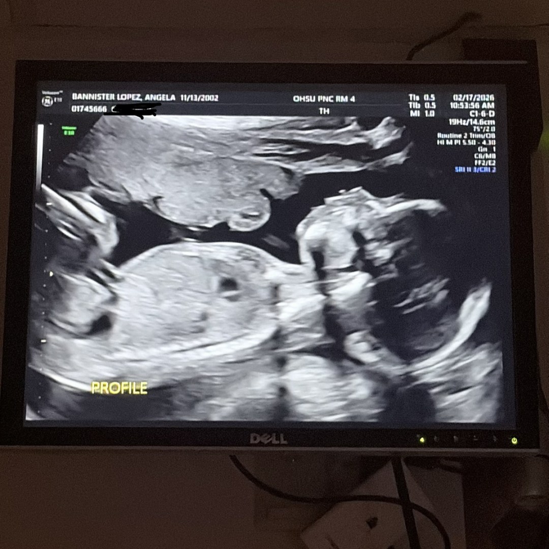 Photo shared by Angela for their Babylist baby registry.