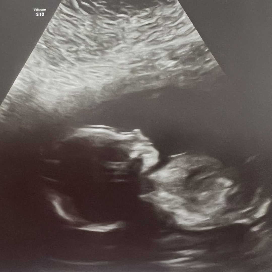 Photo shared by Lauren for their Babylist baby registry.