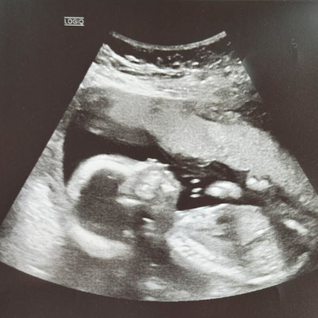 Photo shared by Shelby for their Babylist baby registry.