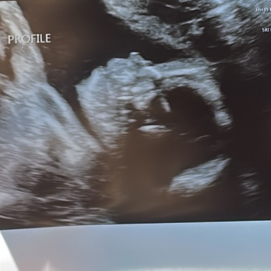 Photo shared by Alina for their Babylist baby registry.