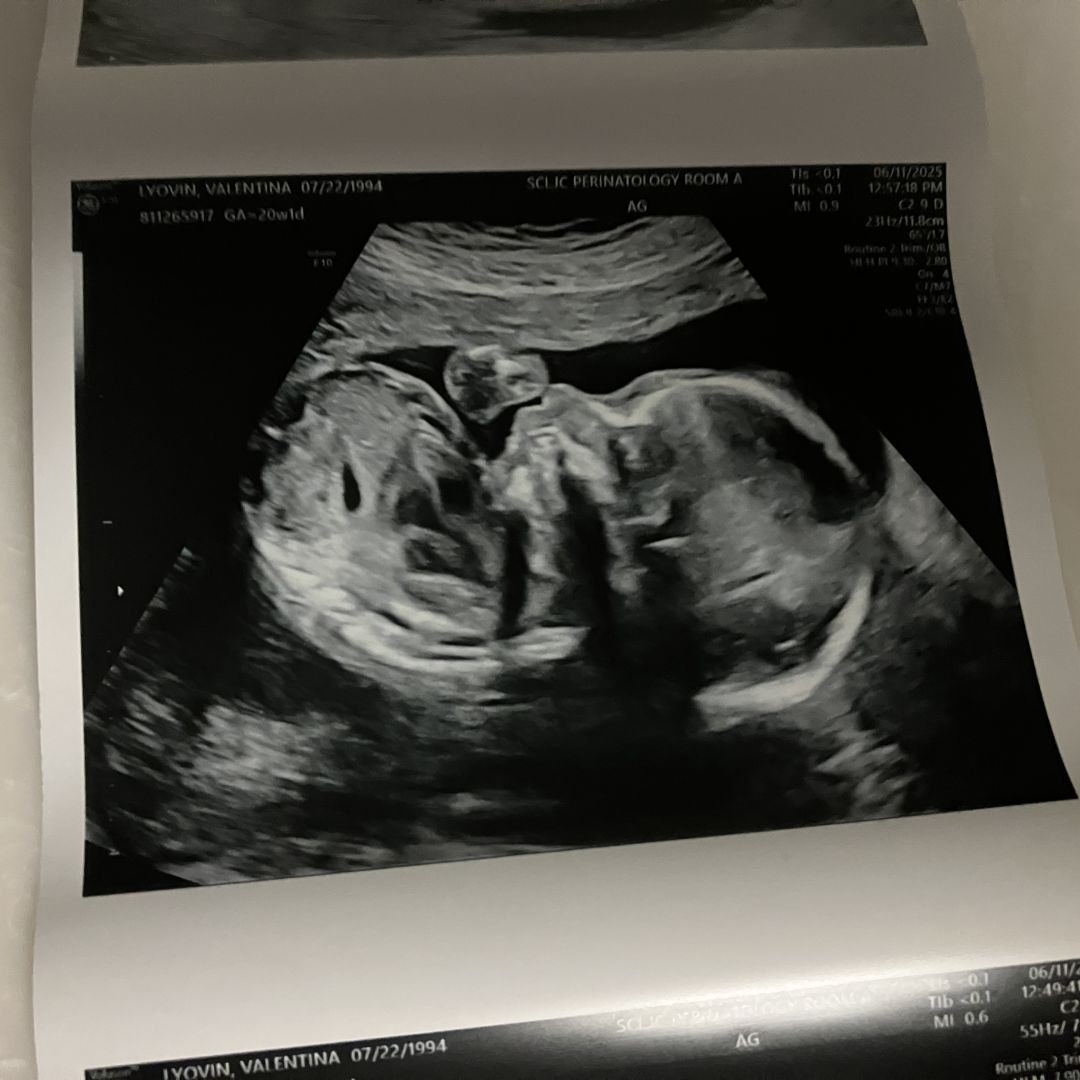 Photo shared by Valentina for their Babylist baby registry.