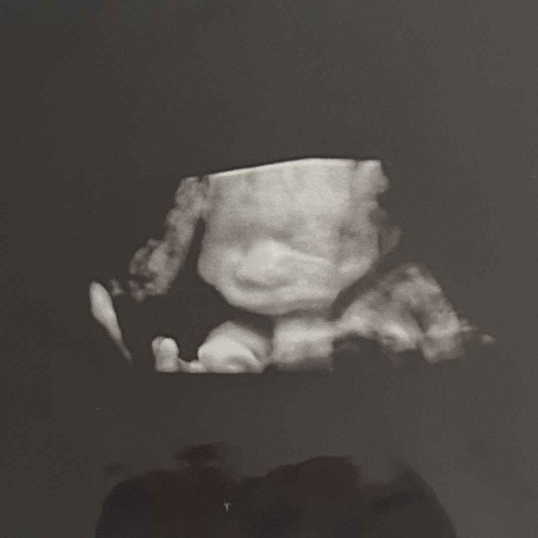 Photo shared by Quintessa for their Babylist baby registry.