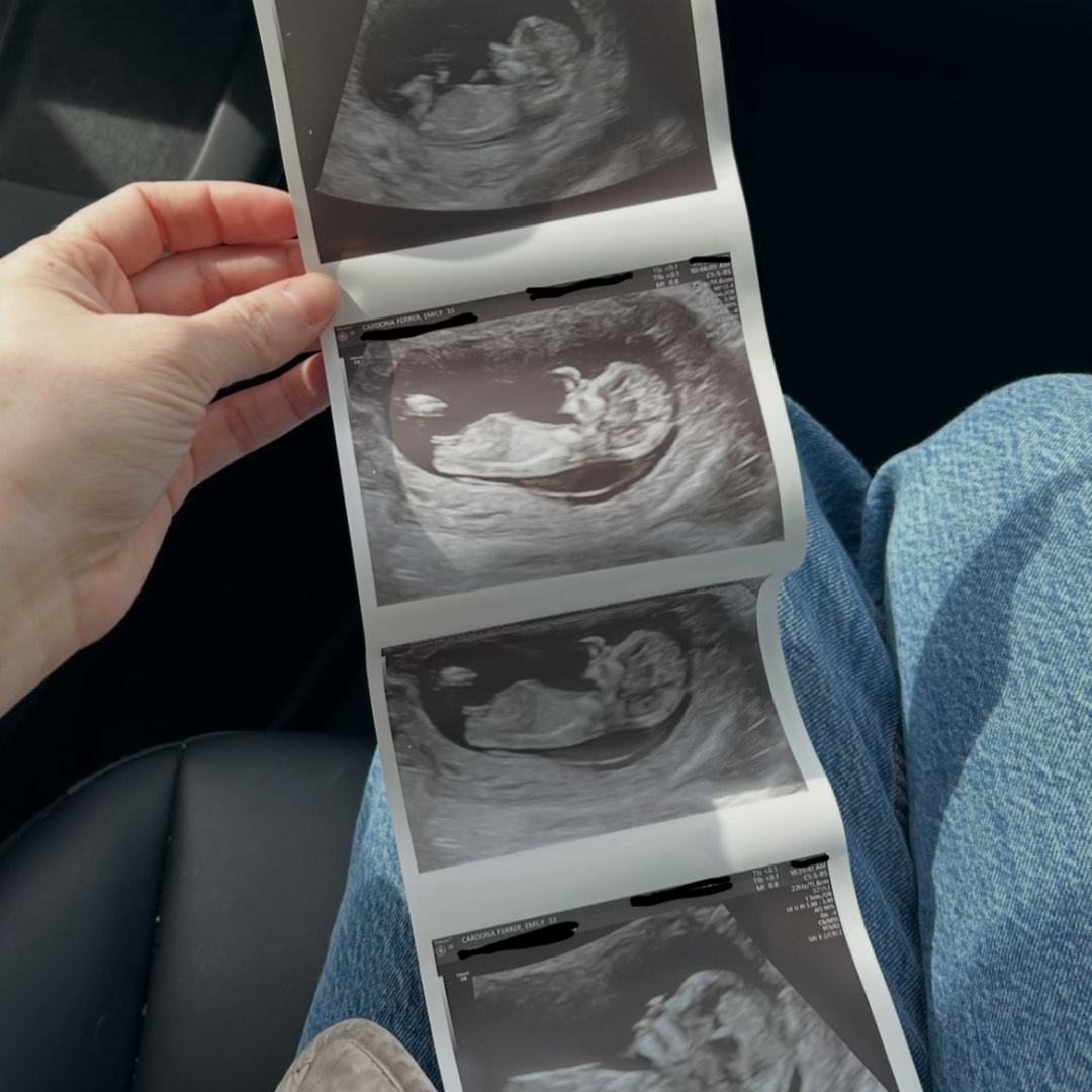 Photo shared by Emily for their Babylist baby registry.