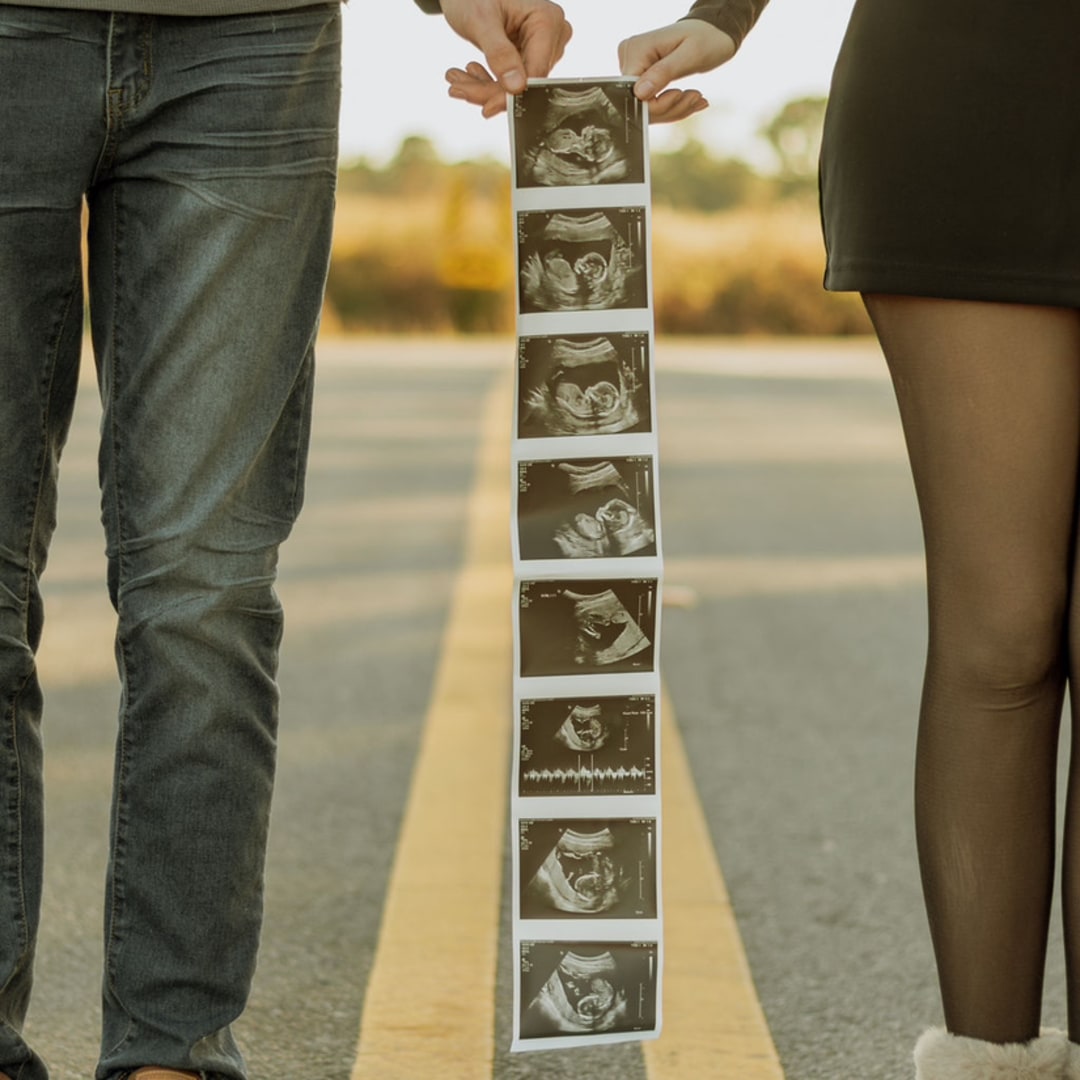 Photo shared by Allison for their Babylist baby registry.