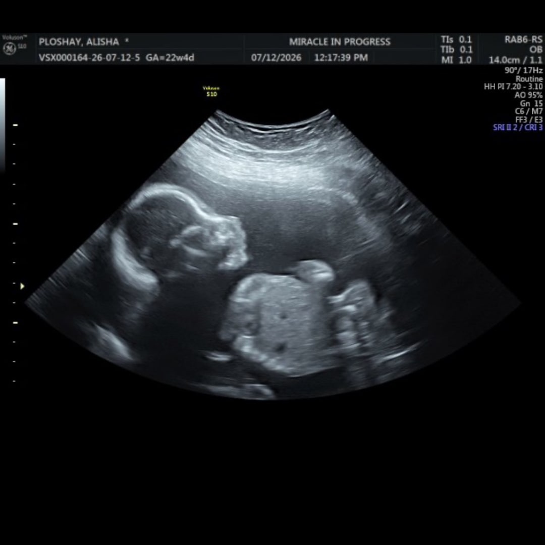Photo shared by Alisha for their Babylist baby registry.