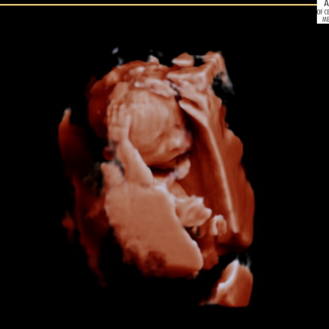 Photo shared by Janil for their Babylist baby registry.