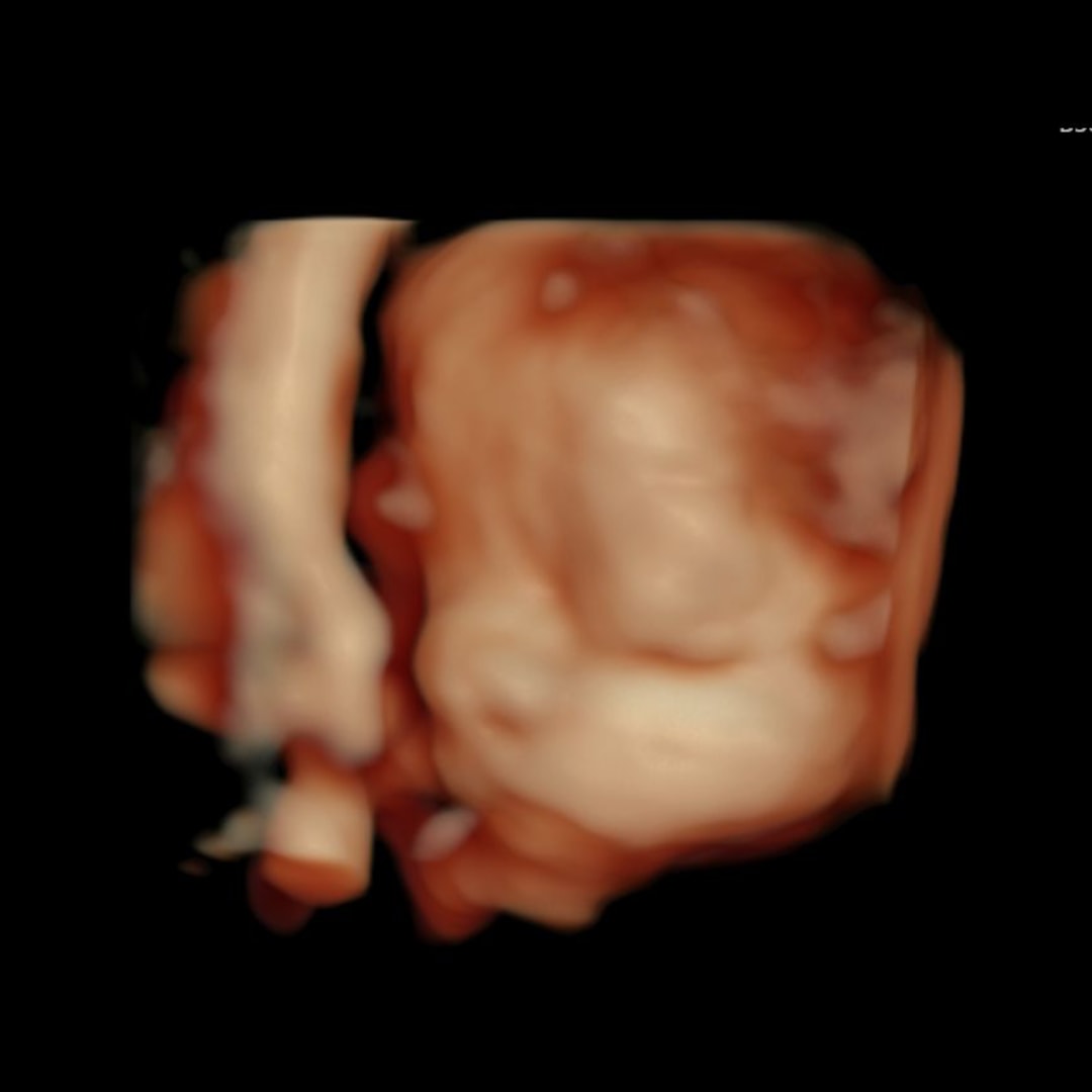 Photo shared by Bradi for their Babylist baby registry.