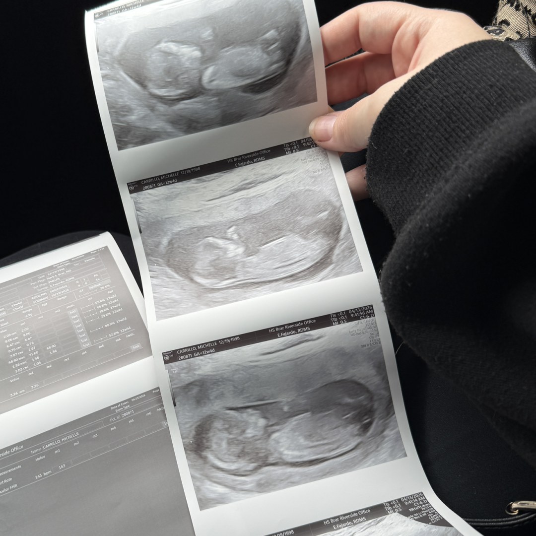 Photo shared by Michelle for their Babylist baby registry.