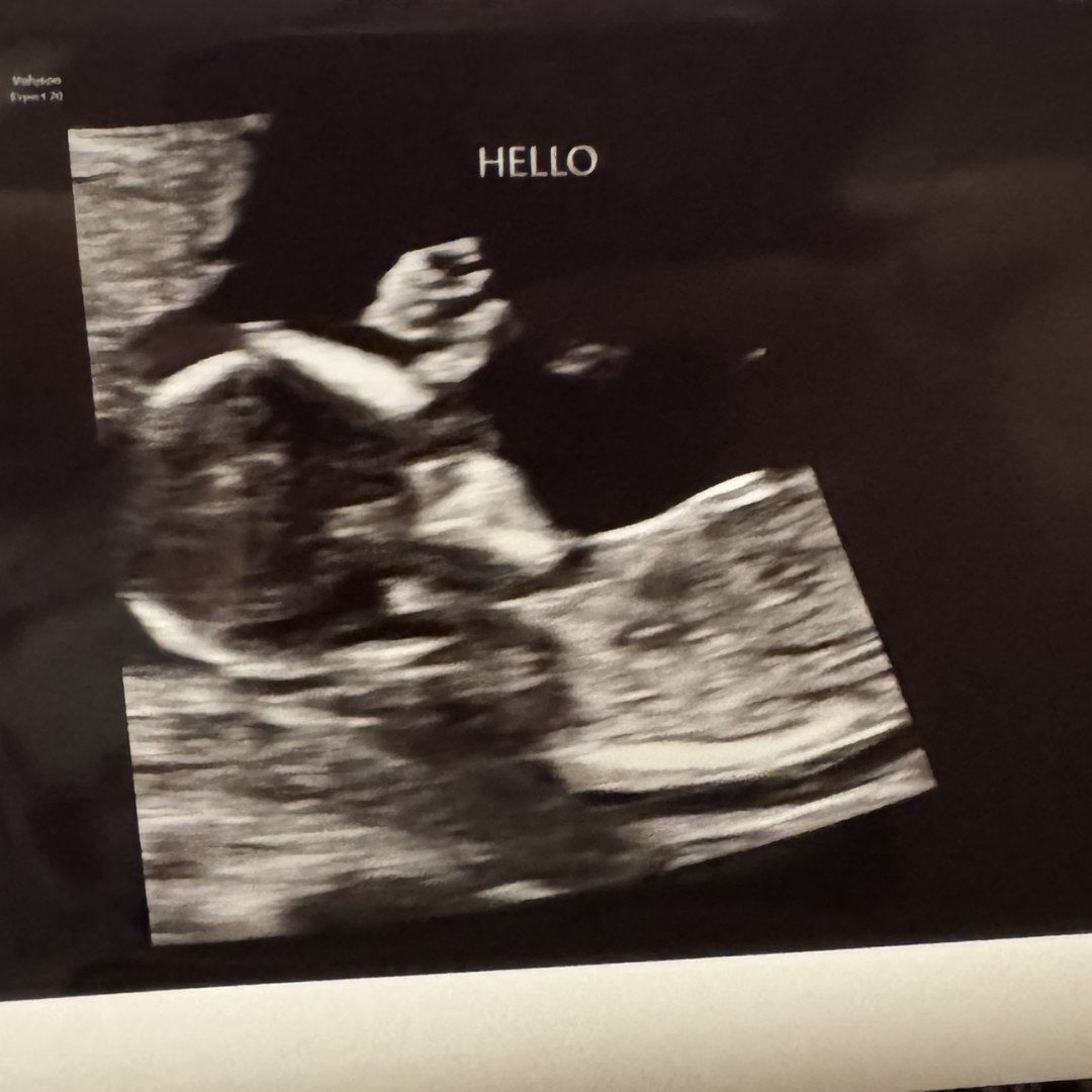 Photo shared by Isabella for their Babylist baby registry.