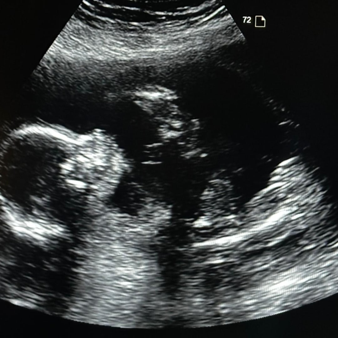 Photo shared by Alisson for their Babylist baby registry.