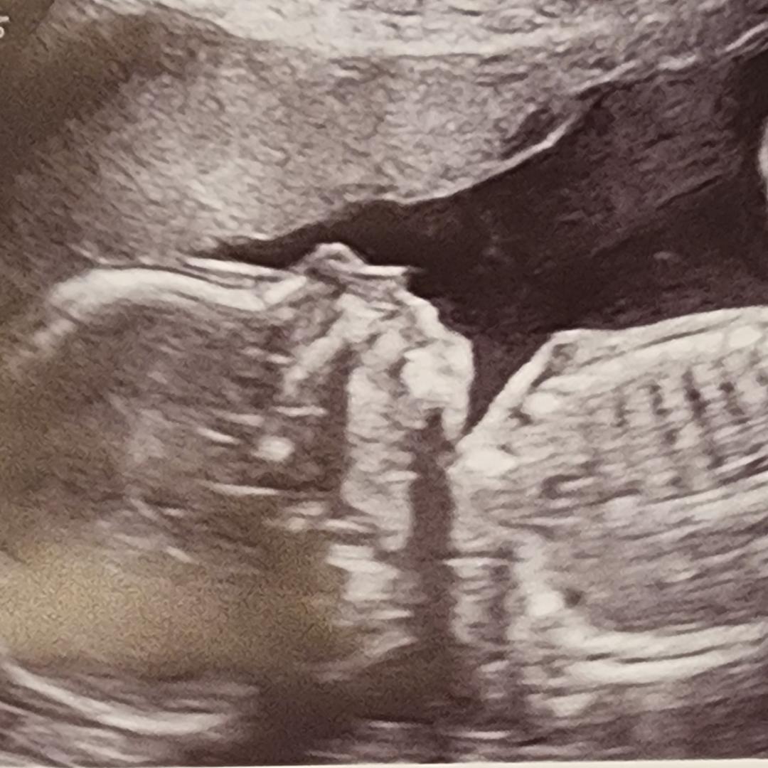 Photo shared by Kate for their Babylist baby registry.